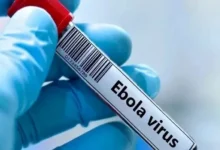 فرنسا تسجل أول حالة إصابة مؤكدة بفيروس إيبولا