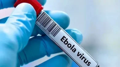 فرنسا تسجل أول حالة إصابة مؤكدة بفيروس إيبولا