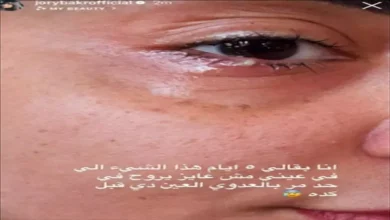 جوري بكر تكشف عن إصابتها بعدوى في عينها